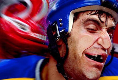 A hockey player missing a tooth.