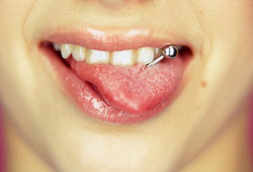 A tongue piercing.