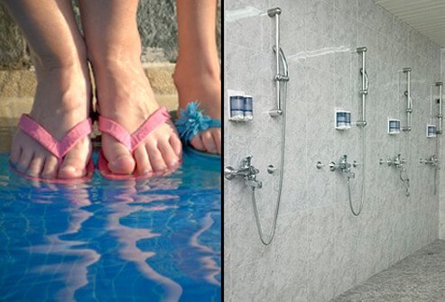 Ringworm prevention tip #2: Wear slippers or sandals in locker rooms and public pool and bathing areas.